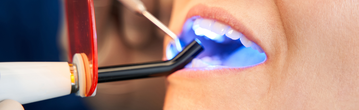 Dental filling Zahnarzt Frankfurt Ost east 